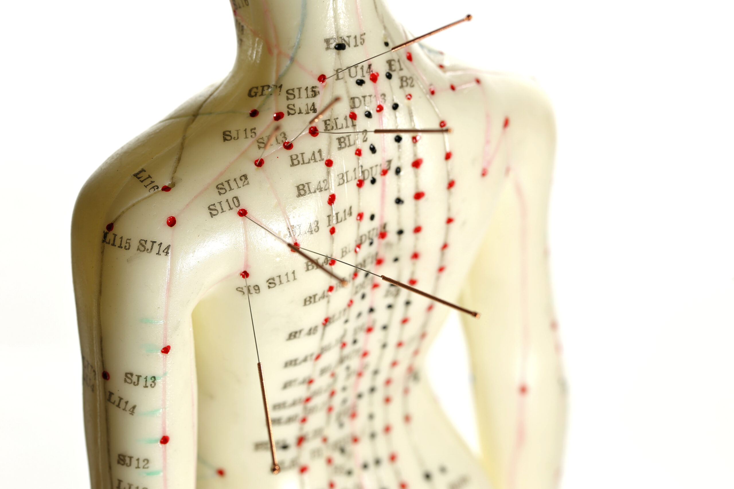 Traditional Chinese Medicine Acupuncture